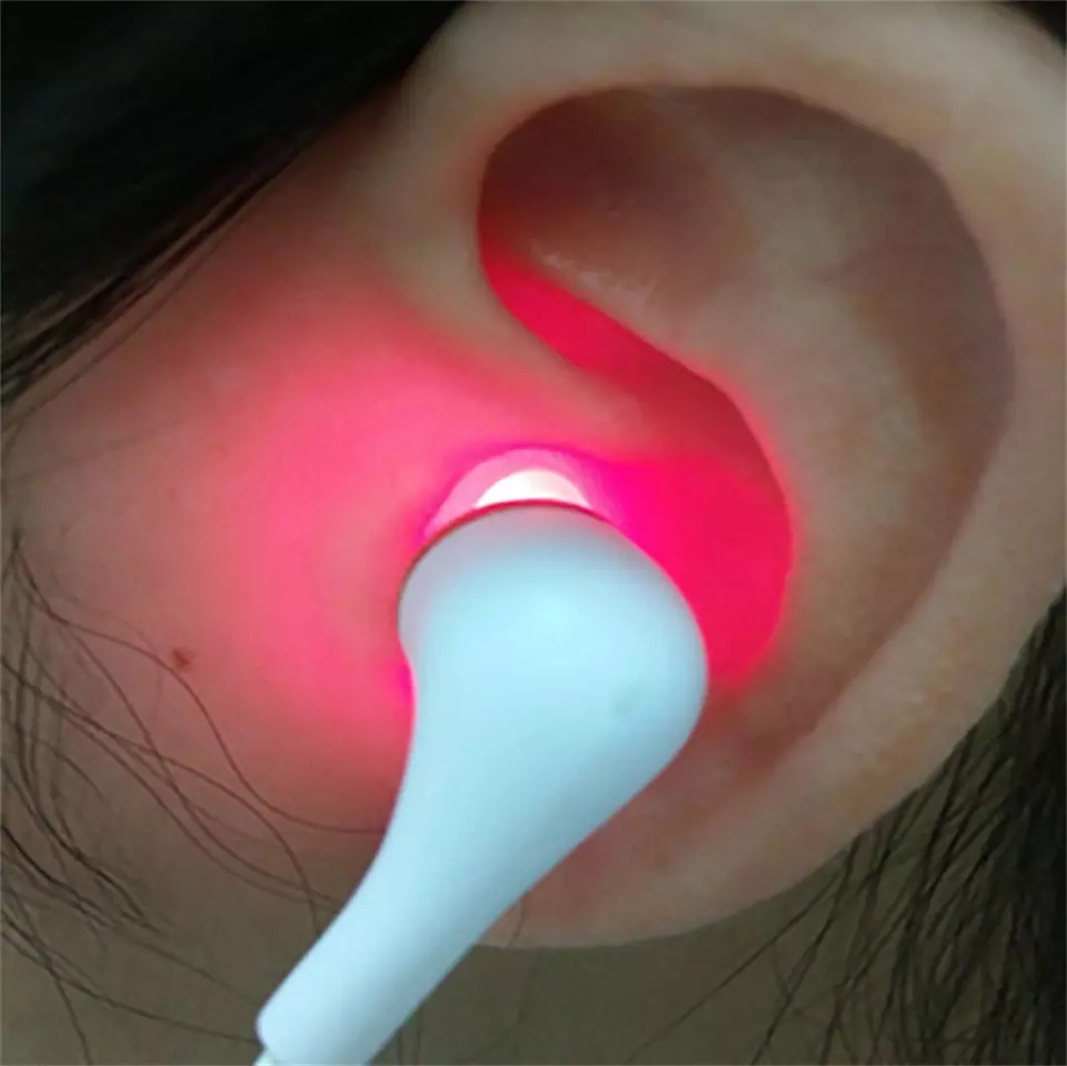 COZING-WS11C Laser Therapy Device for Otitis Media, Tinnitus, and Meniere's Syndrome