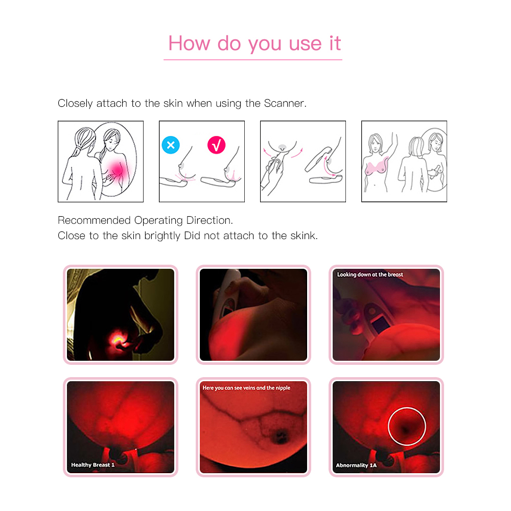 XS01 Breast Light Screening Device for Early Breast Cancer Detection